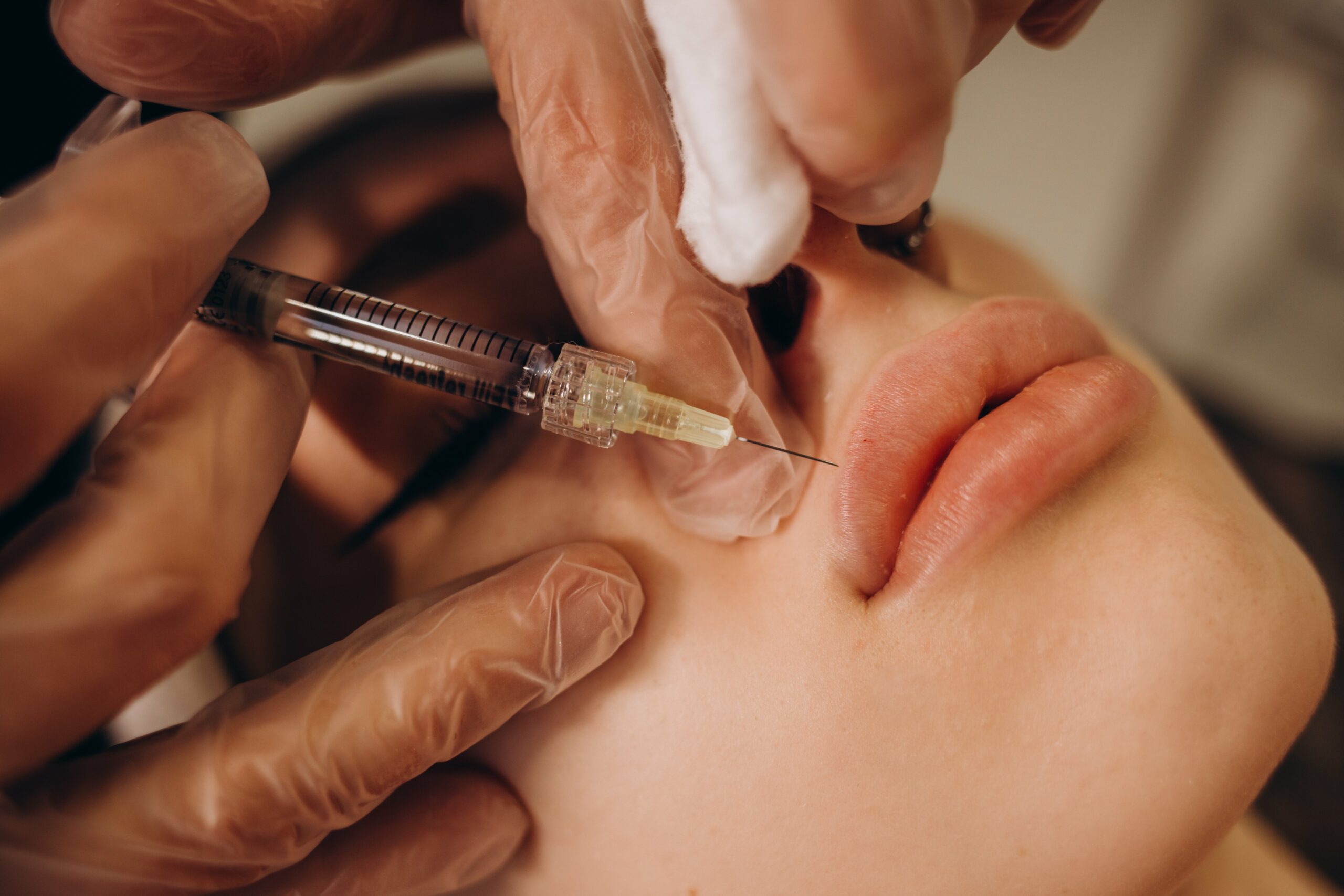 dermal fillers treatment